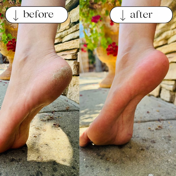 💥LAST DAY SALE 52% OFF - Foot File
