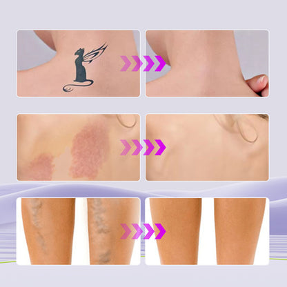 💜Limited Sale 50% OFF 💜Waterproof Tattoo Cover Up Concealer