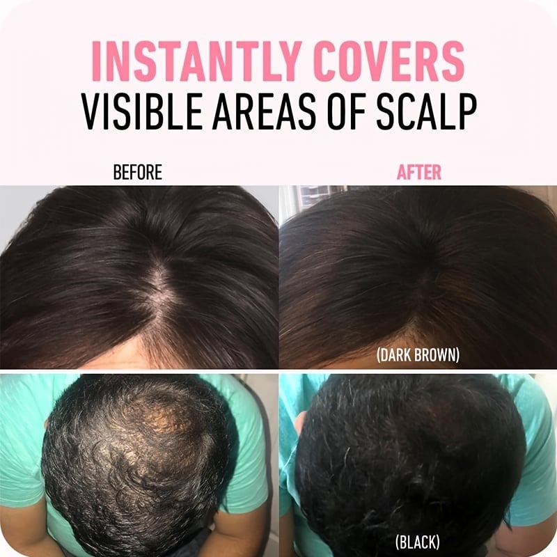 🔥🔥BUY 2 GET 1 FREE💗Hairline Powder  (fit all hair color)🌈