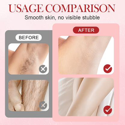 🔥Hot Sale Deals-Portable Dual-Head Electric Epilator