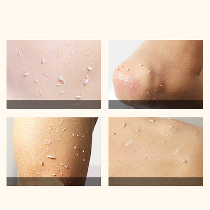 🔥Hot Sale Deals-Orange Enzymes Exfoliating Brightening Gel