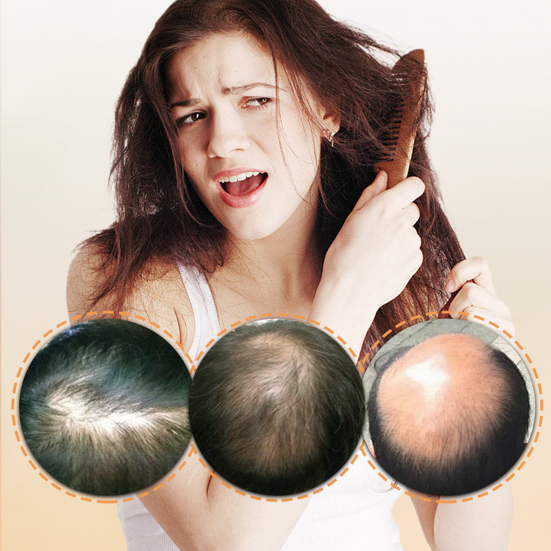 💥💞Limited Time Buy 1 Get 1 Free🎉22g Hair Building Fiber for Instant Volumizing & Thickening