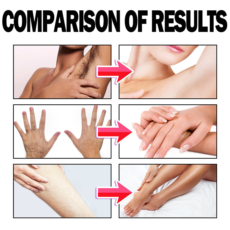 🔥Hot Sale Offers-Smooth Skin Hair Removal Foam Spray