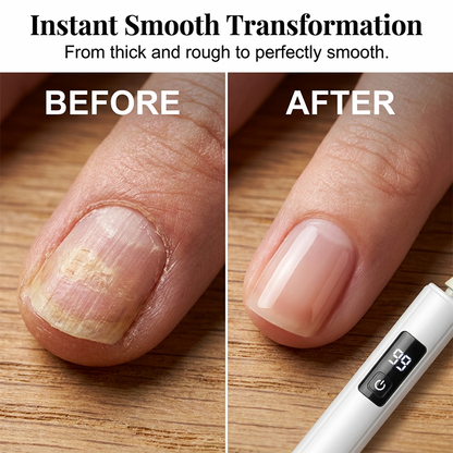 🥳2026 HOT SALE🥳💞50K+ SOLD!💅✨ Professional Electric Nail Polisher – Smooths thick nails, 99-speed display. Multiple heads for shaping & buffing. Salon at home! 🌟💎
